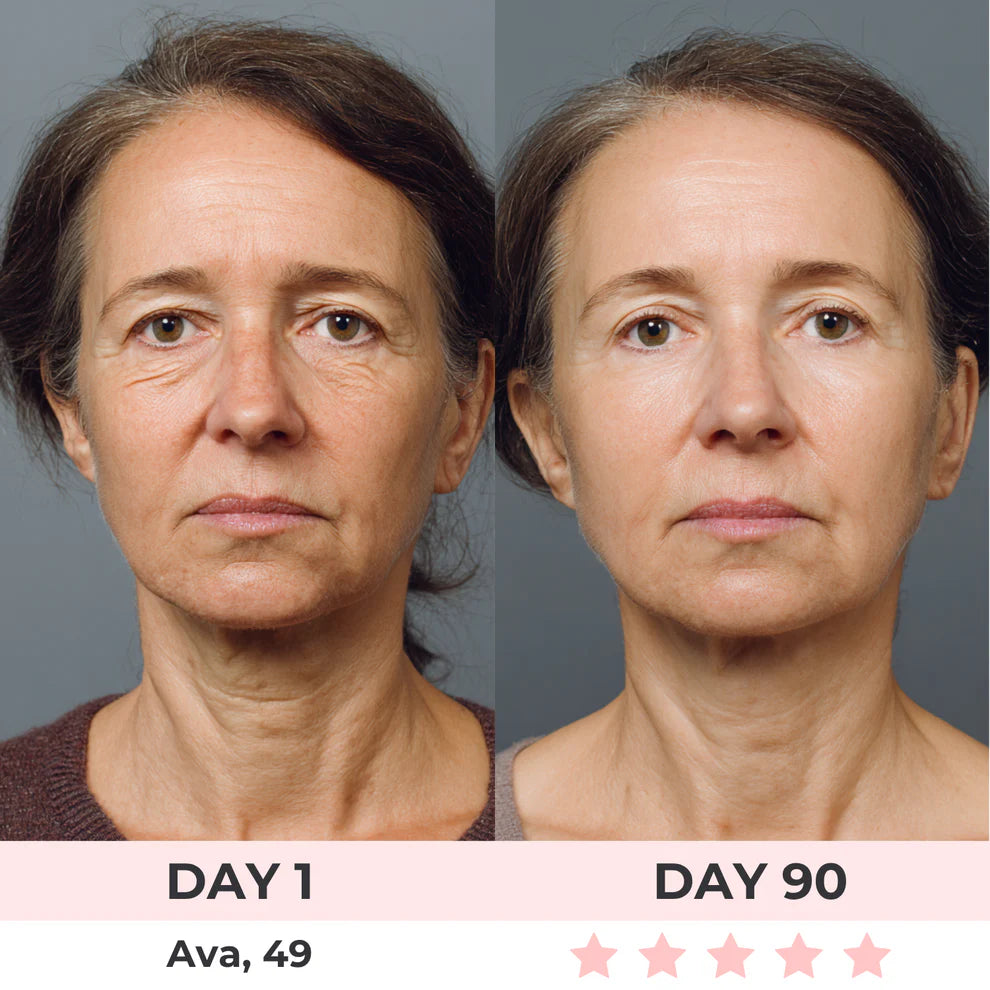 Etherie 7-in-1 LED Facial Sculptor