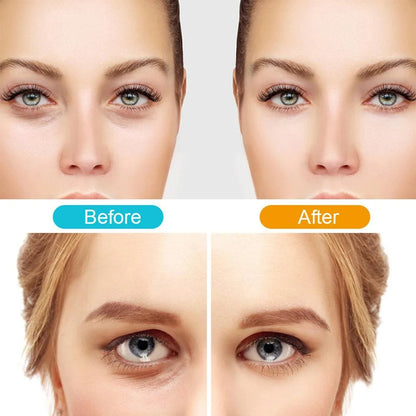 Etherie Red Light Revitalizing Under-Eye Glasses