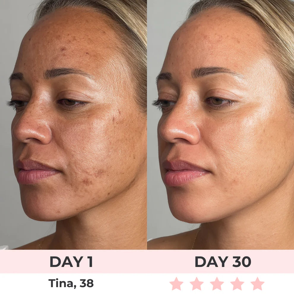 Etherie 7-in-1 LED Facial Sculptor