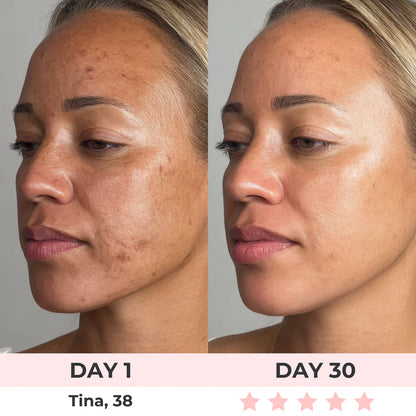 Etherie 7-in-1 LED Facial Sculptor