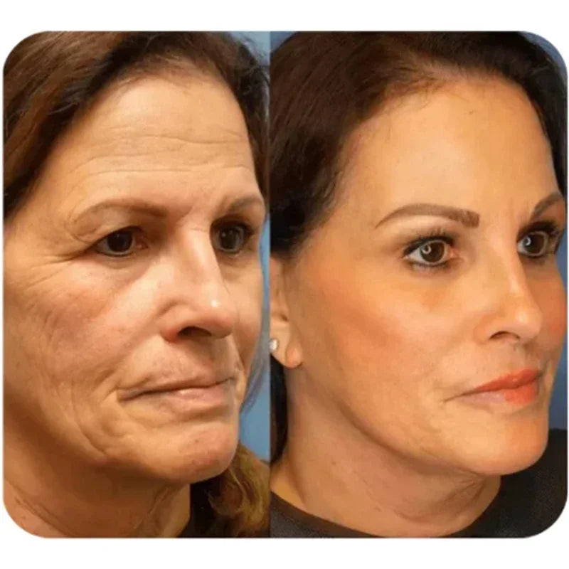 Instant Natural Ageless Beauty Cream